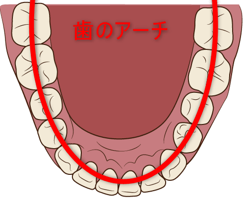 歯のアーチ